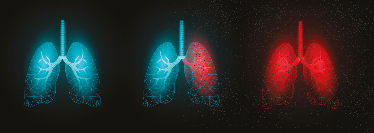 Safeguarding Worker Health: The Hidden Dangers of Silica Dust and the Lindapter Solution